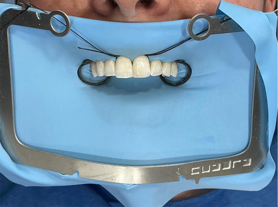 Cuadra Dental Rubber Dam Frame